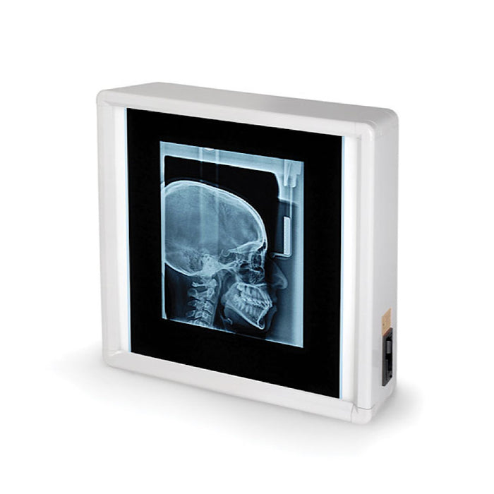 Negativoscopio GIMA disponibile in 5 diverse misure