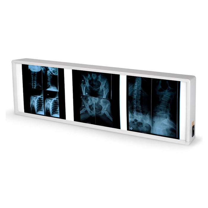 Negativoscopio GIMA disponibile in 5 diverse misure
