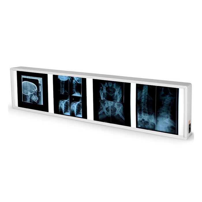 Negativoscopio GIMA disponibile in 5 diverse misure